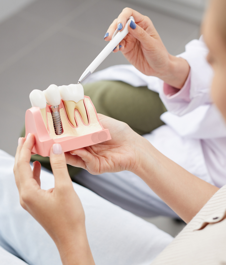 εμφυτεύματα οδοντίατρος Αθήνα